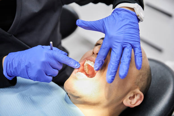 Best Emergency Dental Care for Broken or Chipped Teeth in Santa Clarita, CA
